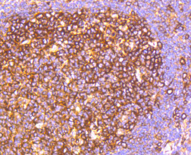 Immunohistochemical analysis of paraffin-embedded human tonsil tissue using anti-HAPLN1 antibody. The section was pre-treated using heat mediated antigen retrieval with Tris-EDTA buffer (pH 8.0-8.4) for 20 minutes.The tissues were blocked in 5% BSA for 30 minutes at room temperature, washed with ddH2O and PBS, and then probed with the primary antibody (ET1607-7, 1/50) for 30 minutes at room temperature. The detection was performed using an HRP conjugated compact polymer system. DAB was used as the chromogen. Tissues were counterstained with hematoxylin and mounted with DPX.