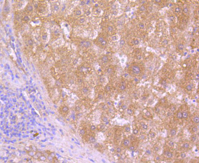 Immunohistochemical analysis of paraffin-embedded human liver tissue using anti-HAPLN1 antibody. The section was pre-treated using heat mediated antigen retrieval with Tris-EDTA buffer (pH 8.0-8.4) for 20 minutes.The tissues were blocked in 5% BSA for 30 minutes at room temperature, washed with ddH2O and PBS, and then probed with the primary antibody (ET1607-7, 1/50) for 30 minutes at room temperature. The detection was performed using an HRP conjugated compact polymer system. DAB was used as the chromogen. Tissues were counterstained with hematoxylin and mounted with DPX.