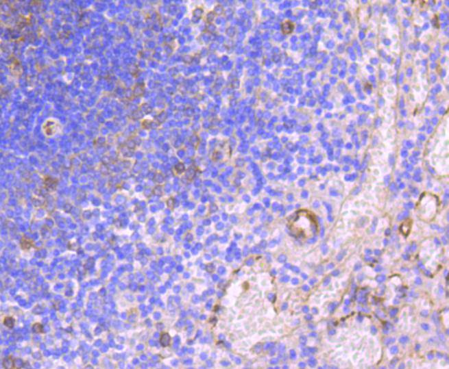 Immunohistochemical analysis of paraffin-embedded human spleen tissue using anti-HAPLN1 antibody. The section was pre-treated using heat mediated antigen retrieval with Tris-EDTA buffer (pH 8.0-8.4) for 20 minutes.The tissues were blocked in 5% BSA for 30 minutes at room temperature, washed with ddH2O and PBS, and then probed with the primary antibody (ET1607-7, 1/50) for 30 minutes at room temperature. The detection was performed using an HRP conjugated compact polymer system. DAB was used as the chromogen. Tissues were counterstained with hematoxylin and mounted with DPX.