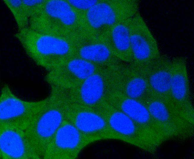 ICC staining of GSK3 beta in Hela cells (green). Formalin fixed cells were permeabilized with 0.1% Triton X-100 in TBS for 10 minutes at room temperature and blocked with 1% Blocker BSA for 15 minutes at room temperature. Cells were probed with the primary antibody (ET1607-71, 1/50) for 1 hour at room temperature, washed with PBS. Alexa Fluor®488 Goat anti-Rabbit IgG was used as the secondary antibody at 1/1,000 dilution. The nuclear counter stain is DAPI (blue).