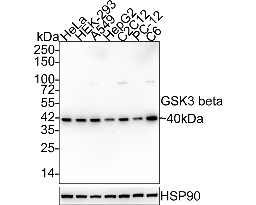 ICC staining of GSK3 beta in PC-3M cells (green). Formalin fixed cells were permeabilized with 0.1% Triton X-100 in TBS for 10 minutes at room temperature and blocked with 1% Blocker BSA for 15 minutes at room temperature. Cells were probed with the primary antibody (ET1607-71, 1/50) for 1 hour at room temperature, washed with PBS. Alexa Fluor®488 Goat anti-Rabbit IgG was used as the secondary antibody at 1/1,000 dilution. The nuclear counter stain is DAPI (blue).