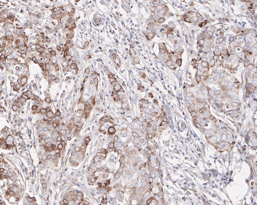 Immunohistochemical analysis of paraffin-embedded mouse testis tissue using anti-GSK3 beta antibody. The section was pre-treated using heat mediated antigen retrieval with Tris-EDTA buffer (pH 8.0-8.4) for 20 minutes.The tissues were blocked in 5% BSA for 30 minutes at room temperature, washed with ddH2O and PBS, and then probed with the primary antibody (ET1607-71, 1/50) for 30 minutes at room temperature. The detection was performed using an HRP conjugated compact polymer system. DAB was used as the chromogen. Tissues were counterstained with hematoxylin and mounted with DPX.