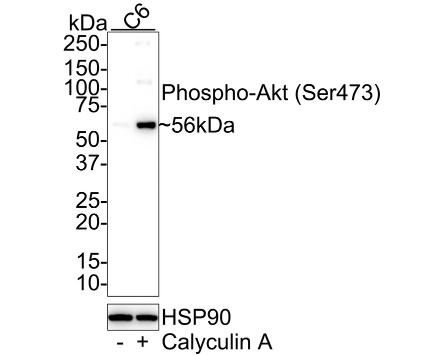 Western blot analysis of Phospho-AKT (S473) on different lysates with Rabbit anti-Phospho-AKT (S473) antibody (ET1607-73) at 1/5,000 dilution.<br />
<br />
Lane 1: C6 cell lysate<br />
Lane 2: C6 treated with 100nM Calyculin A for 30 minutes cell lysate<br />
<br />
Lysates/proteins at 15 µg/Lane.<br />
<br />
Predicted band size: 56 kDa<br />
Observed band size: 56 kDa<br />
<br />
Exposure time: 3 minutes; ECL: K1801;<br />
4-20% SDS-PAGE gel.<br />
<br />
Proteins were transferred to a PVDF membrane and blocked with 5% NFDM/TBST for 1 hour at room temperature. The primary antibody (ET1607-73) at 1/5,000 dilution was used in 5% NFDM/TBST at room temperature for 2 hours. Goat Anti-Rabbit IgG - HRP Secondary Antibody (HA1001) at 1:50,000 dilution was used for 1 hour at room temperature.