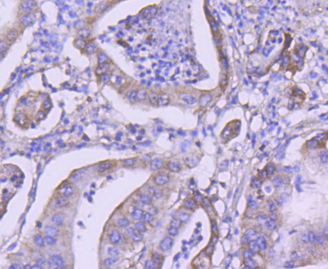 Immunohistochemical analysis of paraffin-embedded rat brain tissue using anti-PI 3 Kinase Class 3 antibody. The section was pre-treated using heat mediated antigen retrieval with Tris-EDTA buffer (pH 8.0-8.4) for 20 minutes.The tissues were blocked in 5% BSA for 30 minutes at room temperature, washed with ddH2O and PBS, and then probed with the primary antibody (ET1607-74, 1/50) for 30 minutes at room temperature. The detection was performed using an HRP conjugated compact polymer system. DAB was used as the chromogen. Tissues were counterstained with hematoxylin and mounted with DPX.
