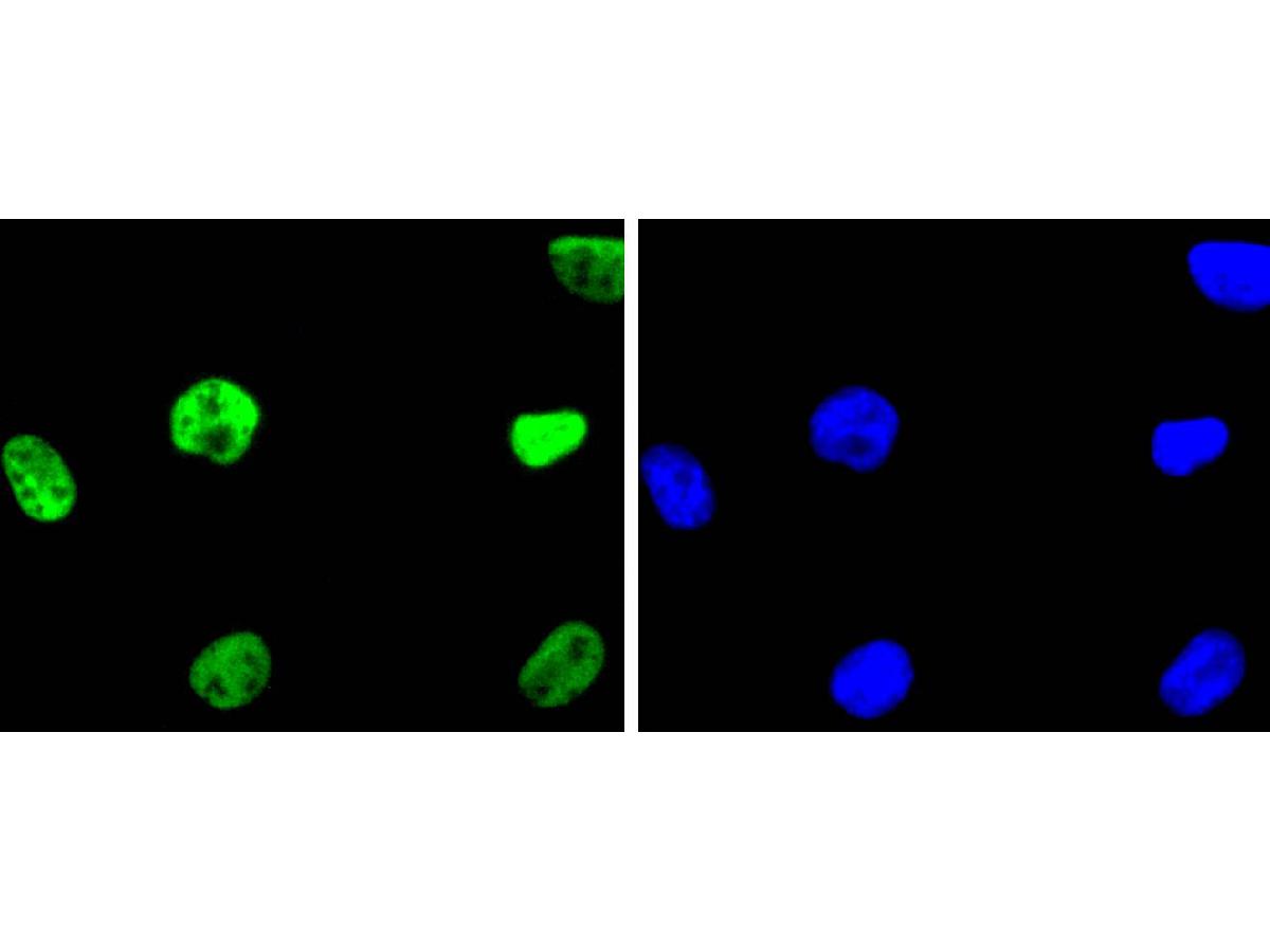 ICC staining of HDAC2 in 293 cells (green). Formalin fixed cells were permeabilized with 0.1% Triton X-100 in TBS for 10 minutes at room temperature and blocked with 1% Blocker BSA for 15 minutes at room temperature. Cells were probed with the primary antibody (ET1607-78, 1/50) for 1 hour at room temperature, washed with PBS. Alexa Fluor®488 Goat anti-Rabbit IgG was used as the secondary antibody at 1/1,000 dilution. The nuclear counter stain is DAPI (blue).