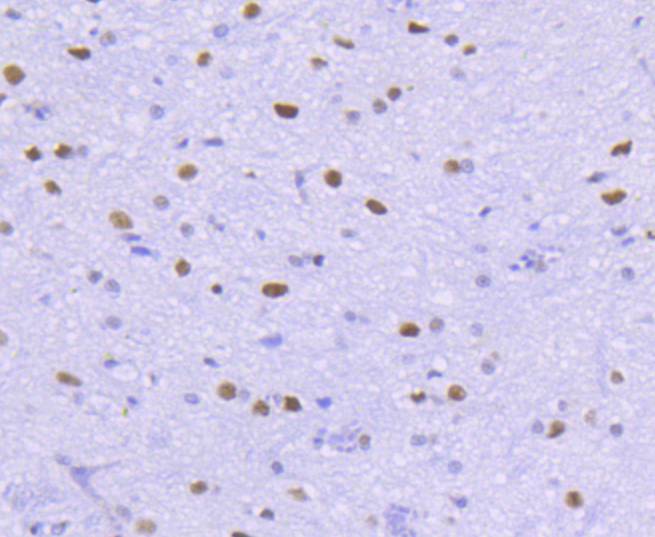 Immunohistochemical analysis of paraffin-embedded rat spinal cord tissue using anti-HDAC2 antibody. The section was pre-treated using heat mediated antigen retrieval with Tris-EDTA buffer (pH 8.0-8.4) for 20 minutes.The tissues were blocked in 5% BSA for 30 minutes at room temperature, washed with ddH2O and PBS, and then probed with the primary antibody (ET1607-78, 1/50) for 30 minutes at room temperature. The detection was performed using an HRP conjugated compact polymer system. DAB was used as the chromogen. Tissues were counterstained with hematoxylin and mounted with DPX.