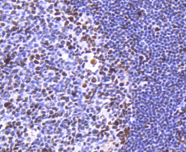 Immunohistochemical analysis of paraffin-embedded human tonsil tissue using anti-HDAC2 antibody. The section was pre-treated using heat mediated antigen retrieval with Tris-EDTA buffer (pH 8.0-8.4) for 20 minutes.The tissues were blocked in 5% BSA for 30 minutes at room temperature, washed with ddH2O and PBS, and then probed with the primary antibody (ET1607-78, 1/50) for 30 minutes at room temperature. The detection was performed using an HRP conjugated compact polymer system. DAB was used as the chromogen. Tissues were counterstained with hematoxylin and mounted with DPX.