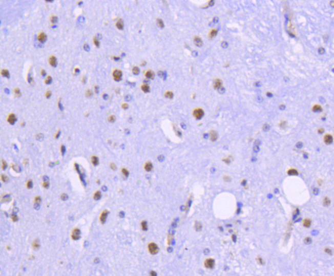 Immunohistochemical analysis of paraffin-embedded mouse spinal cord tissue using anti-HDAC2 antibody. The section was pre-treated using heat mediated antigen retrieval with Tris-EDTA buffer (pH 8.0-8.4) for 20 minutes.The tissues were blocked in 5% BSA for 30 minutes at room temperature, washed with ddH2O and PBS, and then probed with the primary antibody (ET1607-78, 1/50) for 30 minutes at room temperature. The detection was performed using an HRP conjugated compact polymer system. DAB was used as the chromogen. Tissues were counterstained with hematoxylin and mounted with DPX.