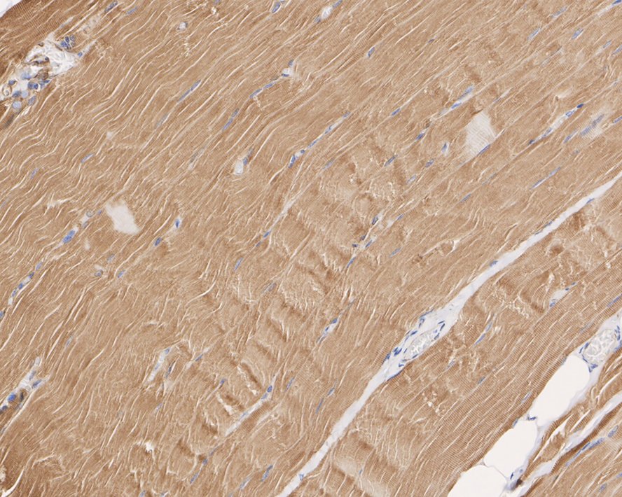Immunohistochemical analysis of paraffin-embedded rat skeletal muscle tissue with Rabbit anti-Plectin antibody (ET1607-80) at 1/500 dilution.<br />
<br />
The section was pre-treated using heat mediated antigen retrieval with Tris-EDTA buffer (pH 9.0) for 20 minutes. The tissues were blocked in 1% BSA for 20 minutes at room temperature, washed with ddH2O and PBS, and then probed with the primary antibody (ET1607-80) at 1/500 dilution for 1 hour at room temperature. The detection was performed using an HRP conjugated compact polymer system. DAB was used as the chromogen. Tissues were counterstained with hematoxylin and mounted with DPX.