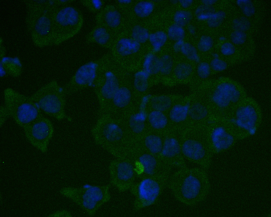 ICC staining of Rb in SW480 cells (green). Formalin fixed cells were permeabilized with 0.1% Triton X-100 in TBS for 10 minutes at room temperature and blocked with 1% Blocker BSA for 15 minutes at room temperature. Cells were probed with the primary antibody (ET1607-9, 1/50) for 1 hour at room temperature, washed with PBS. Alexa Fluor®488 Goat anti-Rabbit IgG was used as the secondary antibody at 1/1,000 dilution. The nuclear counter stain is DAPI (blue).