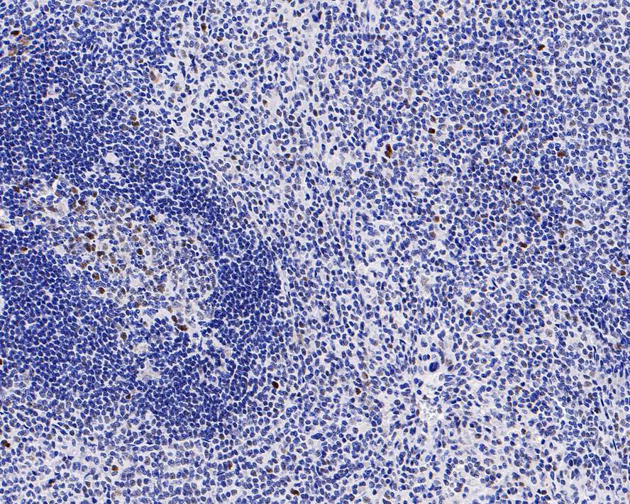 Immunohistochemical analysis of paraffin-embedded human spleen tissue with Rabbit anti-Rb antibody (ET1607-9) at 1/200 dilution.<br />
<br />
The section was pre-treated using heat mediated antigen retrieval with sodium citrate buffer (pH 6.0) for 2 minutes. The tissues were blocked in 1% BSA for 20 minutes at room temperature, washed with ddH2O and PBS, and then probed with the primary antibody (ET1607-9) at 1/200 dilution for 1 hour at room temperature. The detection was performed using an HRP conjugated compact polymer system. DAB was used as the chromogen. Tissues were counterstained with hematoxylin and mounted with DPX.