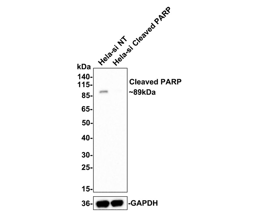 Western blot analysis of Cleaved PARP on different lysates with Rabbit anti-Cleaved PARP antibody (ET1608-10) at 1/500 dilution.<br />
<br />
Lane 1: Hela-si NT cell lysate (10 µg/Lane)<br />
Lane 2: Hela-si Cleaved PARP cell lysate (10 µg/Lane)<br />
<br />
Predicted band size: 89 kDa<br />
Observed band size: 89 kDa<br />
<br />
Exposure time: 3 minutes;<br />
<br />
4-20% SDS-PAGE gel.<br />
<br />
ET1608-10 was shown to specifically react with Cleaved PARP in Hela-si NT cells. No band was observed when Hela-si Cleaved PARP sample was tested. Hela-si NT and Hela-si Cleaved PARP samples were subjected to SDS-PAGE. Proteins were transferred to a PVDF membrane and blocked with 5% NFDM in TBST for 1 hour at room temperature. The primary antibody (ET1608-10, 1/500) and Loading control antibody (Rabbit anti-GAPDH, ET1601-4, 1/10,000) were used in 5% BSA at room temperature for 2 hours. Goat Anti-rabbit IgG-HRP Secondary Antibody (HA1001) at 1:300,000 dilution was used for 1 hour at room temperature.