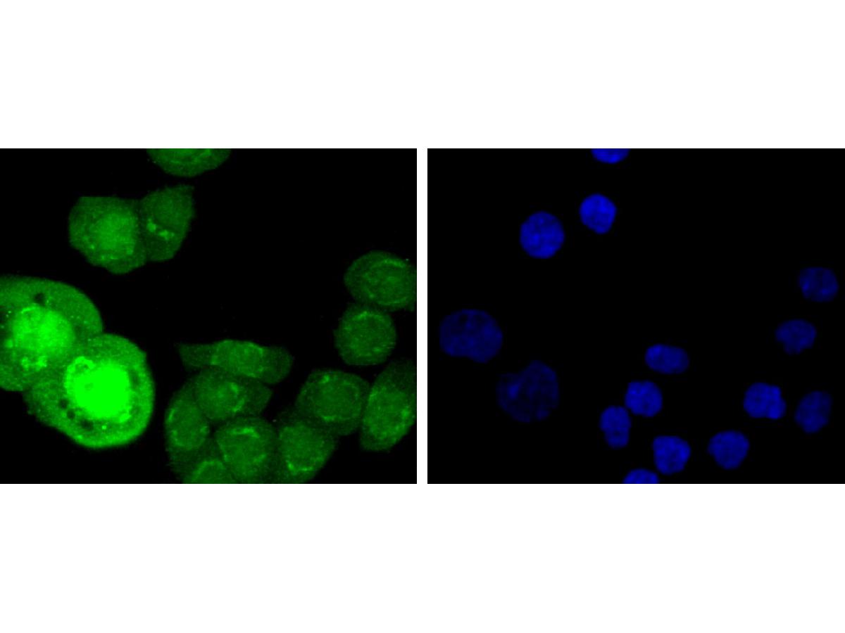 ICC staining of Phospho-HSF1(S326) in Hela cells (green). Formalin fixed cells were permeabilized with 0.1% Triton X-100 in TBS for 10 minutes at room temperature and blocked with 1% Blocker BSA for 15 minutes at room temperature. Cells were probed with the primary antibody (ET1608-11, 1/50) for 1 hour at room temperature, washed with PBS. Alexa Fluor®488 Goat anti-Rabbit IgG was used as the secondary antibody at 1/1,000 dilution. The nuclear counter stain is DAPI (blue).