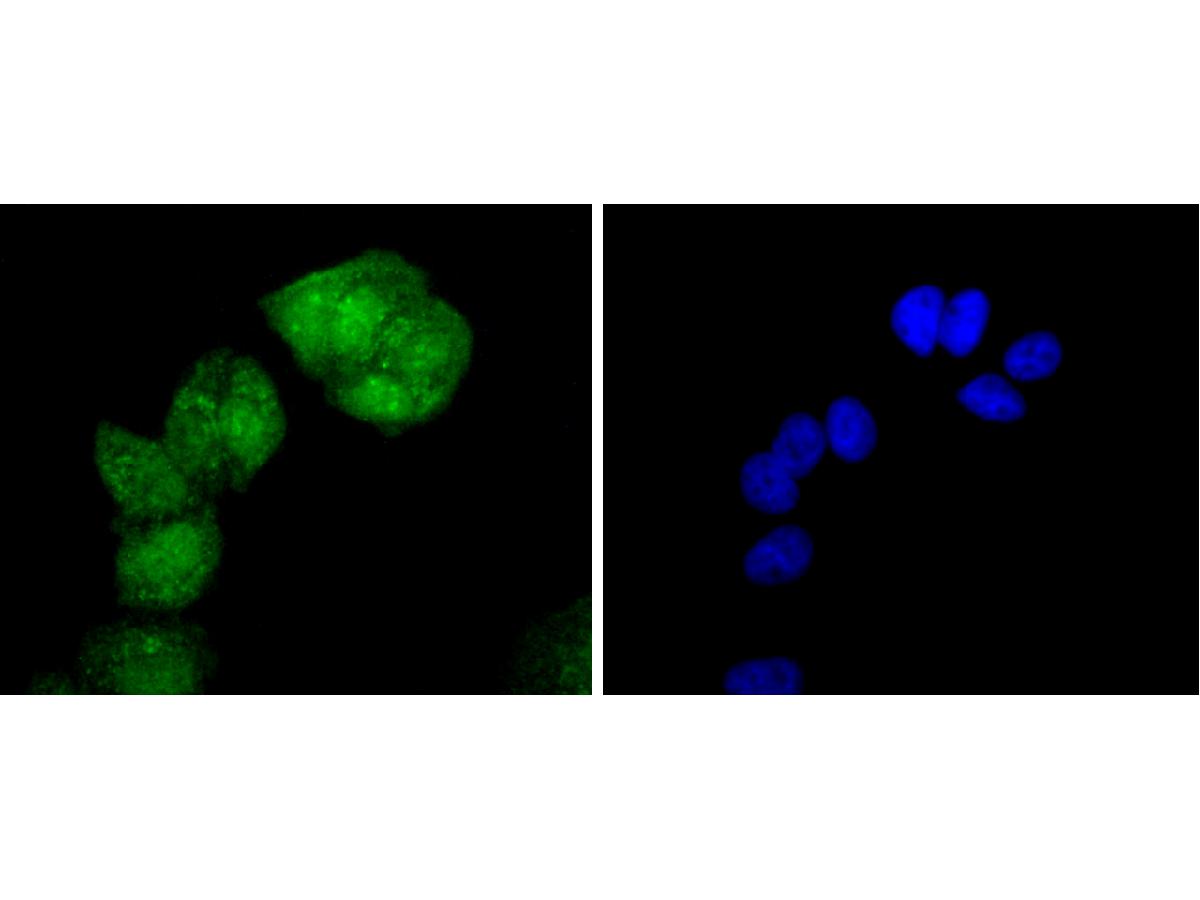 ICC staining of Phospho-HSF1(S326) in AGS cells (green). Formalin fixed cells were permeabilized with 0.1% Triton X-100 in TBS for 10 minutes at room temperature and blocked with 1% Blocker BSA for 15 minutes at room temperature. Cells were probed with the primary antibody (ET1608-11, 1/50) for 1 hour at room temperature, washed with PBS. Alexa Fluor®488 Goat anti-Rabbit IgG was used as the secondary antibody at 1/1,000 dilution. The nuclear counter stain is DAPI (blue).