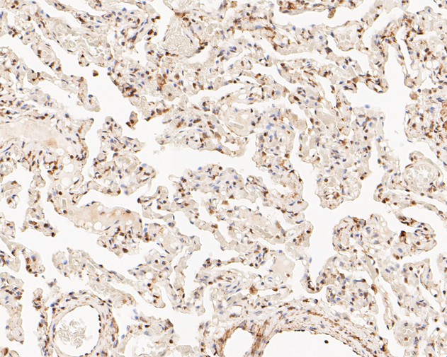 Immunohistochemical analysis of paraffin-embedded human tonsil tissue using anti-Phospho-HSF1(S326) antibody. The section was pre-treated using heat mediated antigen retrieval with sodium citrate buffer (pH 6.0) for 20 minutes. The tissues were blocked in 5% BSA for 30 minutes at room temperature, washed with ddH2O and PBS, and then probed with the primary antibody (ET1608-11, 1/50)  for 30 minutes at room temperature. The detection was performed using an HRP conjugated compact polymer system. DAB was used as the chromogen. Tissues were counterstained with hematoxylin and mounted with DPX.