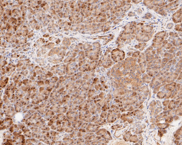 Immunohistochemical analysis of paraffin-embedded human skin tissue using anti-Phospho-HSF1(S326) antibody. The section was pre-treated using heat mediated antigen retrieval with sodium citrate buffer (pH 6.0) for 20 minutes. The tissues were blocked in 5% BSA for 30 minutes at room temperature, washed with ddH2O and PBS, and then probed with the primary antibody (ET1608-11, 1/50)  for 30 minutes at room temperature. The detection was performed using an HRP conjugated compact polymer system. DAB was used as the chromogen. Tissues were counterstained with hematoxylin and mounted with DPX.