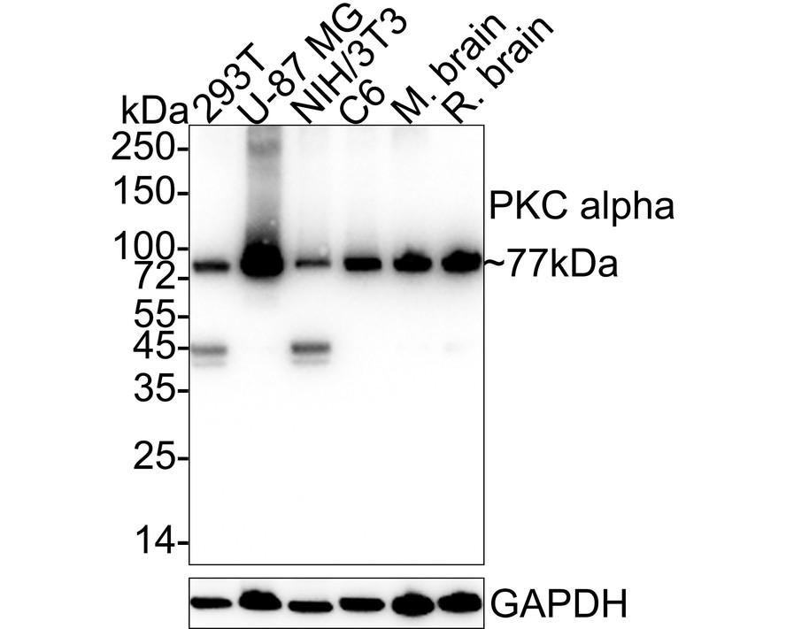 Western blot analysis of PKC alpha on different lysates with Rabbit anti-PKC alpha antibody (ET1608-15) at 1/1,000 dilution.<br />
<br />
Lane 1: 293T cell lysate (20 µg/Lane)<br />
Lane 2: U-87 MG cell lysate (20 µg/Lane)<br />
Lane 3: NIH/3T3 cell lysate (20 µg/Lane)<br />
Lane 4: C6 cell lysate (20 µg/Lane)<br />
Lane 5: Mouse brain tissue lysate (40 µg/Lane)<br />
Lane 6: Rat brain tissue lysate (40 µg/Lane)<br />
<br />
Predicted band size: 77 kDa<br />
Observed band size: 77 kDa<br />
<br />
Exposure time: 9 seconds;<br />
<br />
4-20% SDS-PAGE gel.<br />
<br />
Proteins were transferred to a PVDF membrane and blocked with 5% NFDM/TBST for 1 hour at room temperature. The primary antibody (ET1608-15) at 1/1,000 dilution was used in 5% NFDM/TBST at 4℃ overnight. Goat Anti-Rabbit IgG - HRP Secondary Antibody (HA1001) at 1/50,000 dilution was used for 1 hour at room temperature.