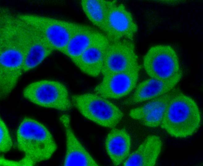 ICC staining of PKC alpha in MCF-7 cells (green). Formalin fixed cells were permeabilized with 0.1% Triton X-100 in TBS for 10 minutes at room temperature and blocked with 10% negative goat serum for 15 minutes at room temperature. Cells were probed with the primary antibody (ET1608-15, 1/50) for 1 hour at room temperature, washed with PBS. Alexa Fluor®488 conjugate-Goat anti-Rabbit IgG was used as the secondary antibody at 1/1,000 dilution. The nuclear counter stain is DAPI (blue).