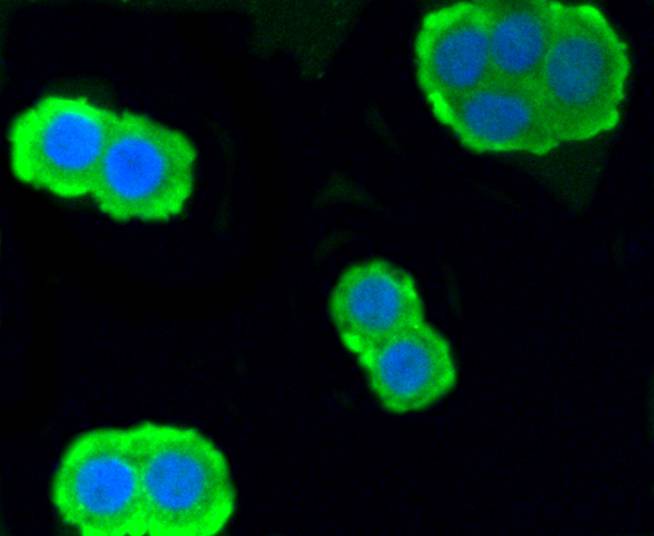 ICC staining of PKC alpha in CRC cells (green). Formalin fixed cells were permeabilized with 0.1% Triton X-100 in TBS for 10 minutes at room temperature and blocked with 10% negative goat serum for 15 minutes at room temperature. Cells were probed with the primary antibody (ET1608-15, 1/50) for 1 hour at room temperature, washed with PBS. Alexa Fluor®488 conjugate-Goat anti-Rabbit IgG was used as the secondary antibody at 1/1,000 dilution. The nuclear counter stain is DAPI (blue).