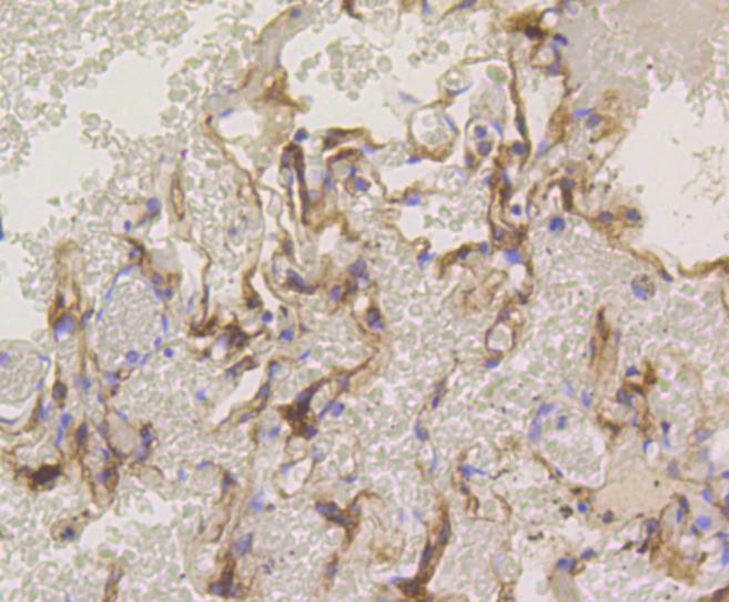 Immunohistochemical analysis of paraffin-embedded human lung tissue using anti-PKC alpha antibody. The section was pre-treated using heat mediated antigen retrieval with Tris-EDTA buffer (pH 9.0) for 20 minutes.The tissues were blocked in 1% BSA for 30 minutes at room temperature, washed with ddH2O and PBS, and then probed with the primary antibody (ET1608-15, 1/50) for 30 minutes at room temperature. The detection was performed using an HRP conjugated compact polymer system. DAB was used as the chromogen. Tissues were counterstained with hematoxylin and mounted with DPX.