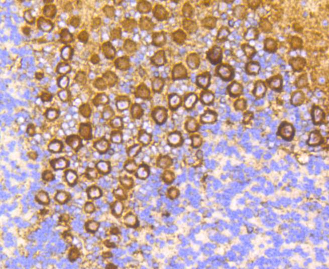 Immunohistochemical analysis of paraffin-embedded mouse brain tissue using anti-PKC alpha antibody. The section was pre-treated using heat mediated antigen retrieval with Tris-EDTA buffer (pH 9.0) for 20 minutes.The tissues were blocked in 1% BSA for 30 minutes at room temperature, washed with ddH2O and PBS, and then probed with the primary antibody (ET1608-15, 1/50) for 30 minutes at room temperature. The detection was performed using an HRP conjugated compact polymer system. DAB was used as the chromogen. Tissues were counterstained with hematoxylin and mounted with DPX.