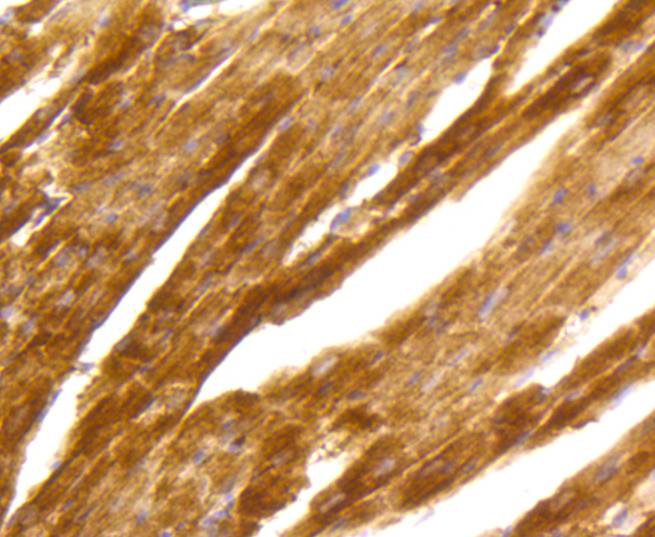 Immunohistochemical analysis of paraffin-embedded mouse heart tissue using anti-PKC alpha antibody. The section was pre-treated using heat mediated antigen retrieval with Tris-EDTA buffer (pH 9.0) for 20 minutes.The tissues were blocked in 1% BSA for 30 minutes at room temperature, washed with ddH2O and PBS, and then probed with the primary antibody (ET1608-15, 1/50) for 30 minutes at room temperature. The detection was performed using an HRP conjugated compact polymer system. DAB was used as the chromogen. Tissues were counterstained with hematoxylin and mounted with DPX.