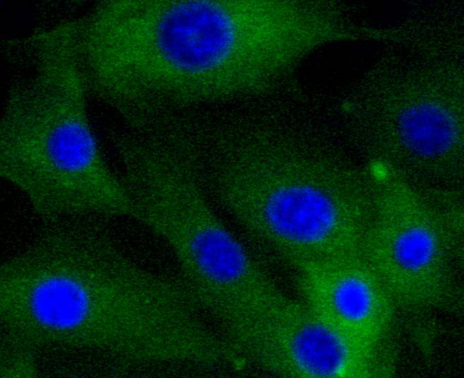 ICC staining of Caldesmon in NIH/3T3 cells (green). Formalin fixed cells were permeabilized with 0.1% Triton X-100 in TBS for 10 minutes at room temperature and blocked with 10% negative goat serum for 15 minutes at room temperature. Cells were probed with the primary antibody (ET1608-16, 1/50) for 1 hour at room temperature, washed with PBS. Alexa Fluor®488 conjugate-Goat anti-Rabbit IgG was used as the secondary antibody at 1/1,000 dilution. The nuclear counter stain is DAPI (blue).