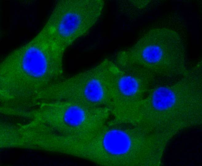 ICC staining of Caldesmon in C2C12 cells (green). Formalin fixed cells were permeabilized with 0.1% Triton X-100 in TBS for 10 minutes at room temperature and blocked with 10% negative goat serum for 15 minutes at room temperature. Cells were probed with the primary antibody (ET1608-16, 1/50) for 1 hour at room temperature, washed with PBS. Alexa Fluor®488 conjugate-Goat anti-Rabbit IgG was used as the secondary antibody at 1/1,000 dilution. The nuclear counter stain is DAPI (blue).