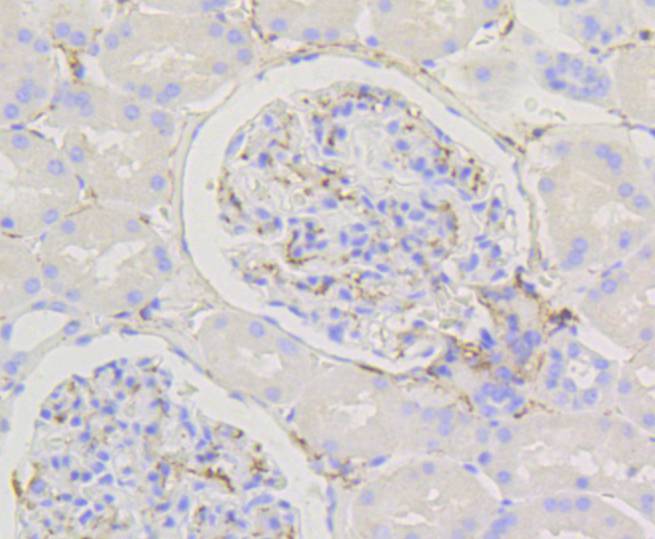 Immunohistochemical analysis of paraffin-embedded human kidney tissue using anti-Caldesmon antibody. The section was pre-treated using heat mediated antigen retrieval with Tris-EDTA buffer (pH 9.0) for 20 minutes.The tissues were blocked in 5% BSA for 30 minutes at room temperature, washed with ddH2O and PBS, and then probed with the primary antibody (ET1608-16, 1/50) for 30 minutes at room temperature. The detection was performed using an HRP conjugated compact polymer system. DAB was used as the chromogen. Tissues were counterstained with hematoxylin and mounted with DPX.