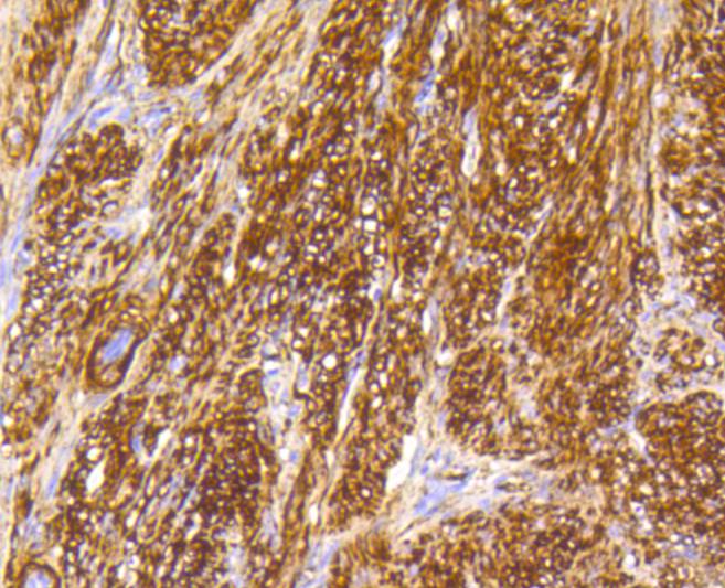 Immunohistochemical analysis of paraffin-embedded human uterus tissue using anti-Caldesmon antibody. The section was pre-treated using heat mediated antigen retrieval with Tris-EDTA buffer (pH 9.0) for 20 minutes.The tissues were blocked in 5% BSA for 30 minutes at room temperature, washed with ddH2O and PBS, and then probed with the primary antibody (ET1608-16, 1/50) for 30 minutes at room temperature. The detection was performed using an HRP conjugated compact polymer system. DAB was used as the chromogen. Tissues were counterstained with hematoxylin and mounted with DPX.