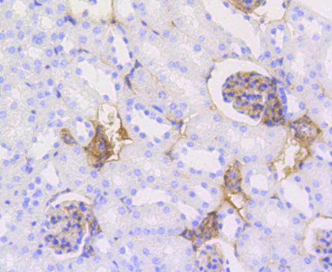 Immunohistochemical analysis of paraffin-embedded mouse kidney tissue using anti-Caldesmon antibody. The section was pre-treated using heat mediated antigen retrieval with Tris-EDTA buffer (pH 9.0) for 20 minutes.The tissues were blocked in 5% BSA for 30 minutes at room temperature, washed with ddH2O and PBS, and then probed with the primary antibody (ET1608-16, 1/50) for 30 minutes at room temperature. The detection was performed using an HRP conjugated compact polymer system. DAB was used as the chromogen. Tissues were counterstained with hematoxylin and mounted with DPX.