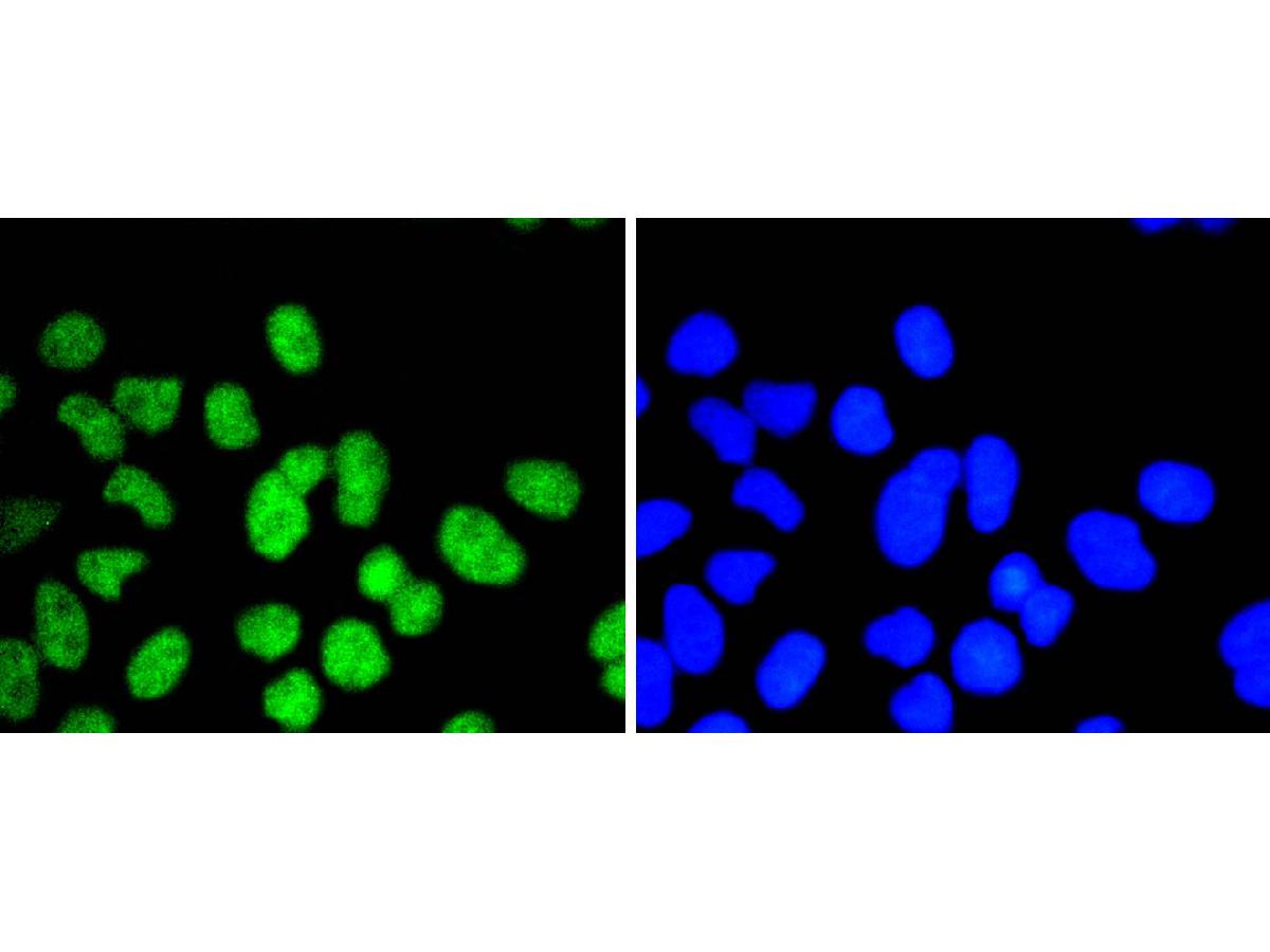 ICC staining of ELK1 in Hela cells (green). Formalin fixed cells were permeabilized with 0.1% Triton X-100 in TBS for 10 minutes at room temperature and blocked with 1% Blocker BSA for 15 minutes at room temperature. Cells were probed with the primary antibody (ET1608-19, 1/100) for 1 hour at room temperature, washed with PBS. Alexa Fluor®488 Goat anti-Rabbit IgG was used as the secondary antibody at 1/1,000 dilution. The nuclear counter stain is DAPI (blue).