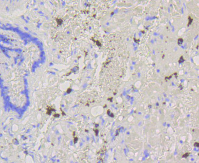 Immunohistochemical analysis of paraffin-embedded human lung tissue using anti-ABCG1 antibody. The section was pre-treated using heat mediated antigen retrieval with Tris-EDTA buffer (pH 8.0-8.4) for 20 minutes.The tissues were blocked in 5% BSA for 30 minutes at room temperature, washed with ddH2O and PBS, and then probed with the primary antibody (ET1608-20, 1/50) for 30 minutes at room temperature. The detection was performed using an HRP conjugated compact polymer system. DAB was used as the chromogen. Tissues were counterstained with hematoxylin and mounted with DPX.
