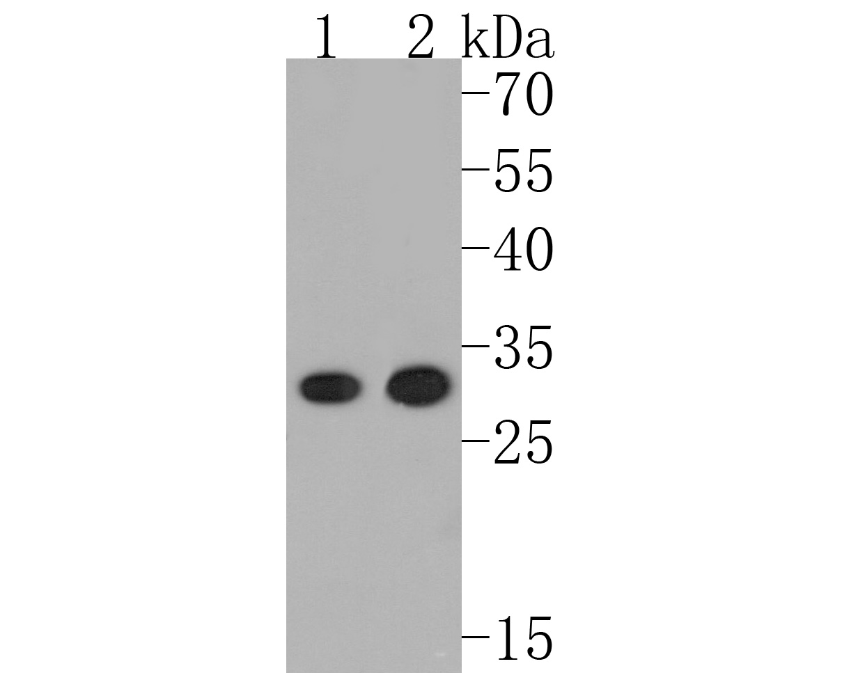Western blot analysis of DARPP32 on different lysates. Proteins were transferred to a PVDF membrane and blocked with 5% BSA in PBS for 1 hour at room temperature. The primary antibody (ET1608-23, 1/500) was used in 5% BSA at room temperature for 2 hours. Goat Anti-Rabbit IgG - HRP Secondary Antibody (HA1001) at 1:200,000 dilution was used for 1 hour at room temperature.
Positive control: 
Lane 1: Mouse brain tissue lysate
Lane 2: Rat brain tissue lysate