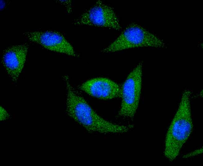 ICC staining of DARPP32 in SH-SY5Y cells (green). Formalin fixed cells were permeabilized with 0.1% Triton X-100 in TBS for 10 minutes at room temperature and blocked with 1% Blocker BSA for 15 minutes at room temperature. Cells were probed with the primary antibody (ET1608-23, 1/50) for 1 hour at room temperature, washed with PBS. Alexa Fluor®488 Goat anti-Rabbit IgG was used as the secondary antibody at 1/1,000 dilution. The nuclear counter stain is DAPI (blue).