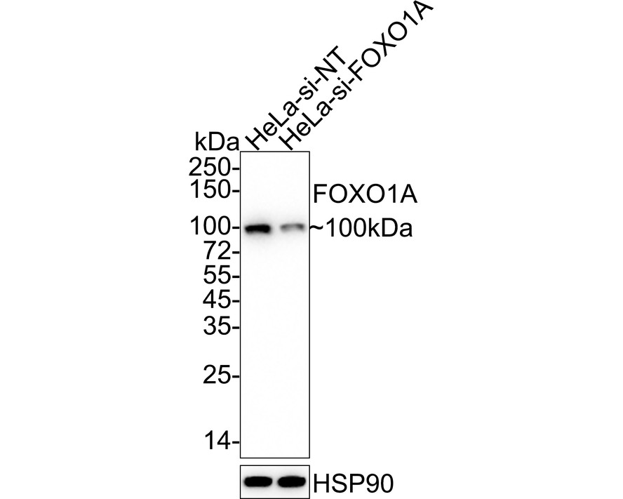 Immunocytochemistry analysis of NIH/3T3 cells labeling FOXO1A with Rabbit anti-FOXO1A antibody (ET1608-25) at 1/50 dilution.<br />
<br />
Cells were fixed in 4% paraformaldehyde for 10 minutes at 37 ℃, permeabilized with 0.05% Triton X-100 in PBS for 20 minutes, and then blocked with 2% negative goat serum for 30 minutes at room temperature. Cells were then incubated with Rabbit anti-FOXO1A antibody (ET1608-25) at 1/50 dilution in 2% negative goat serum overnight at 4 ℃. Goat Anti-Rabbit IgG H&L (iFluor™ 488, HA1121) was used as the secondary antibody at 1/1,000 dilution. PBS instead of the primary antibody was used as the secondary antibody only control. Nuclear DNA was labelled in blue with DAPI.