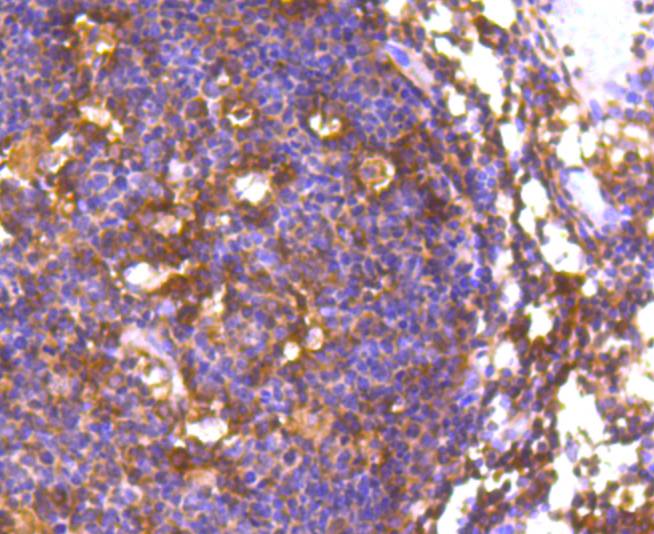Immunohistochemical analysis of paraffin-embedded mouse brain tissue using anti-FOXO1A antibody. The section was pre-treated using heat mediated antigen retrieval with Tris-EDTA buffer (pH 8.0-8.4) for 20 minutes.The tissues were blocked in 5% BSA for 30 minutes at room temperature, washed with ddH2O and PBS, and then probed with the primary antibody (ET1608-25, 1/50) for 30 minutes at room temperature. The detection was performed using an HRP conjugated compact polymer system. DAB was used as the chromogen. Tissues were counterstained with hematoxylin and mounted with DPX.
