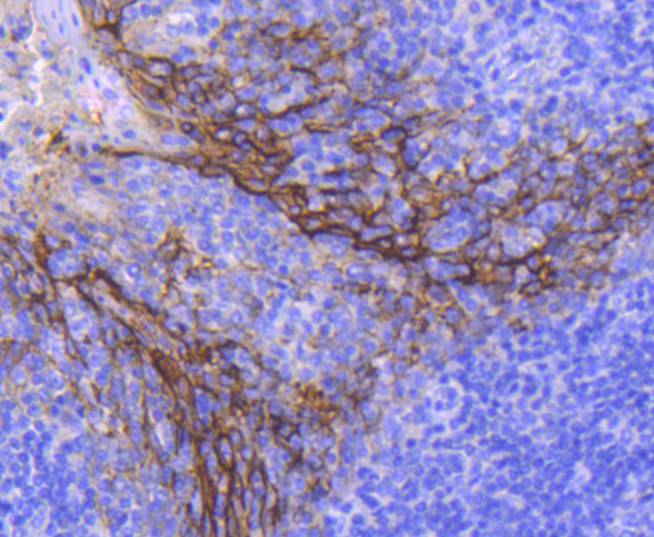 Immunohistochemical analysis of paraffin-embedded human liver tissue using anti-EpCAM antibody. The section was pre-treated using heat mediated antigen retrieval with Tris-EDTA buffer (pH 8.0-8.4) for 20 minutes.The tissues were blocked in 5% BSA for 30 minutes at room temperature, washed with ddH2O and PBS, and then probed with the primary antibody (ET1608-26, 1/50) for 30 minutes at room temperature. The detection was performed using an HRP conjugated compact polymer system. DAB was used as the chromogen. Tissues were counterstained with hematoxylin and mounted with DPX.