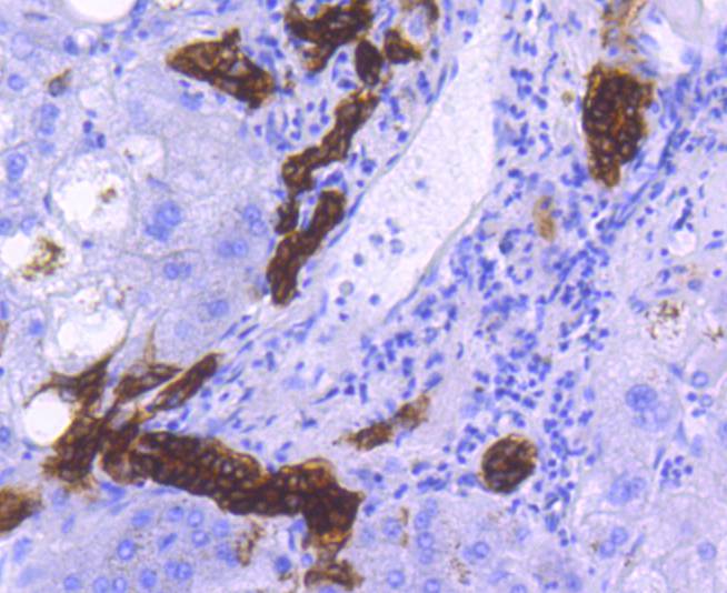 Immunohistochemical analysis of paraffin-embedded human colon tissue using anti-EpCAM antibody. The section was pre-treated using heat mediated antigen retrieval with Tris-EDTA buffer (pH 8.0-8.4) for 20 minutes.The tissues were blocked in 5% BSA for 30 minutes at room temperature, washed with ddH2O and PBS, and then probed with the primary antibody (ET1608-26, 1/50) for 30 minutes at room temperature. The detection was performed using an HRP conjugated compact polymer system. DAB was used as the chromogen. Tissues were counterstained with hematoxylin and mounted with DPX.
