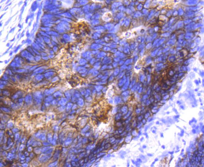 Immunohistochemical analysis of paraffin-embedded mouse kidney tissue using anti-EpCAM antibody. The section was pre-treated using heat mediated antigen retrieval with Tris-EDTA buffer (pH 8.0-8.4) for 20 minutes.The tissues were blocked in 5% BSA for 30 minutes at room temperature, washed with ddH2O and PBS, and then probed with the primary antibody (ET1608-26, 1/50) for 30 minutes at room temperature. The detection was performed using an HRP conjugated compact polymer system. DAB was used as the chromogen. Tissues were counterstained with hematoxylin and mounted with DPX.