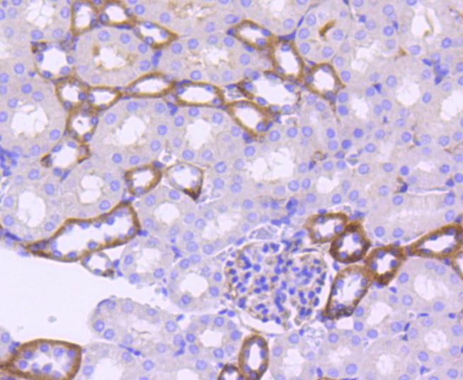 Immunohistochemical analysis of paraffin-embedded human breast tissue using anti-EpCAM antibody. The section was pre-treated using heat mediated antigen retrieval with Tris-EDTA buffer (pH 8.0-8.4) for 20 minutes.The tissues were blocked in 5% BSA for 30 minutes at room temperature, washed with ddH2O and PBS, and then probed with the primary antibody (ET1608-26, 1/50) for 30 minutes at room temperature. The detection was performed using an HRP conjugated compact polymer system. DAB was used as the chromogen. Tissues were counterstained with hematoxylin and mounted with DPX.