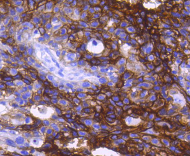 Immunohistochemical analysis of paraffin-embedded mouse stomach tissue using anti-EpCAM antibody. The section was pre-treated using heat mediated antigen retrieval with Tris-EDTA buffer (pH 8.0-8.4) for 20 minutes.The tissues were blocked in 5% BSA for 30 minutes at room temperature, washed with ddH2O and PBS, and then probed with the primary antibody (ET1608-26, 1/50) for 30 minutes at room temperature. The detection was performed using an HRP conjugated compact polymer system. DAB was used as the chromogen. Tissues were counterstained with hematoxylin and mounted with DPX.
