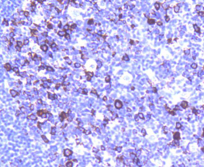 Immunohistochemical analysis of paraffin-embedded human tonsil tissue using anti-Cyclin B1 antibody. The section was pre-treated using heat mediated antigen retrieval with Tris-EDTA buffer (pH 8.0-8.4) for 20 minutes.The tissues were blocked in 5% BSA for 30 minutes at room temperature, washed with ddH2O and PBS, and then probed with the primary antibody (ET1608-27, 1/50) for 30 minutes at room temperature. The detection was performed using an HRP conjugated compact polymer system. DAB was used as the chromogen. Tissues were counterstained with hematoxylin and mounted with DPX.