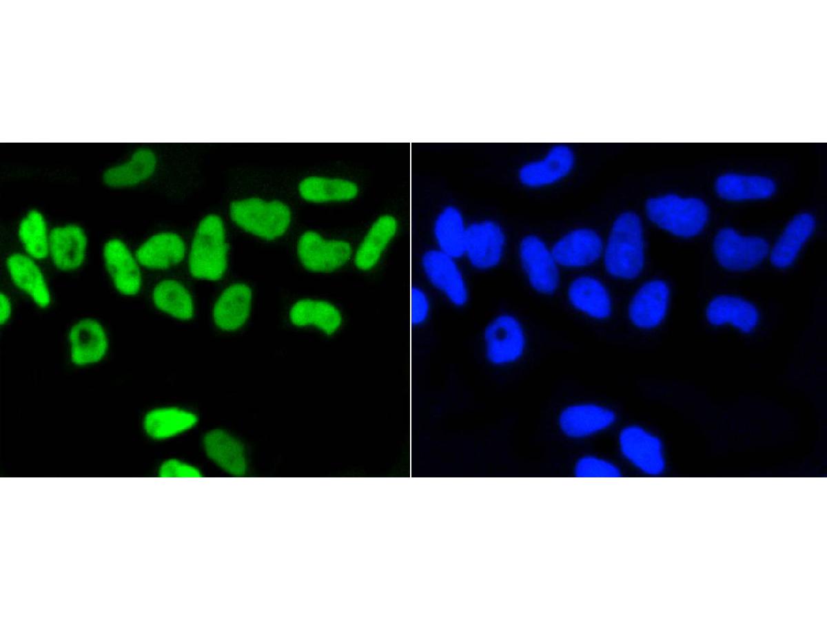 ICC staining of Phospho-Nrf2(S40) in A549 cells (green). Formalin fixed cells were permeabilized with 0.1% Triton X-100 in TBS for 10 minutes at room temperature and blocked with 10% negative goat serum for 15 minutes at room temperature. Cells were probed with the primary antibody (ET1608-28, 1/50) for 1 hour at room temperature, washed with PBS. Alexa Fluor®488 conjugate-Goat anti-Rabbit IgG was used as the secondary antibody at 1/1,000 dilution. The nuclear counter stain is DAPI (blue).