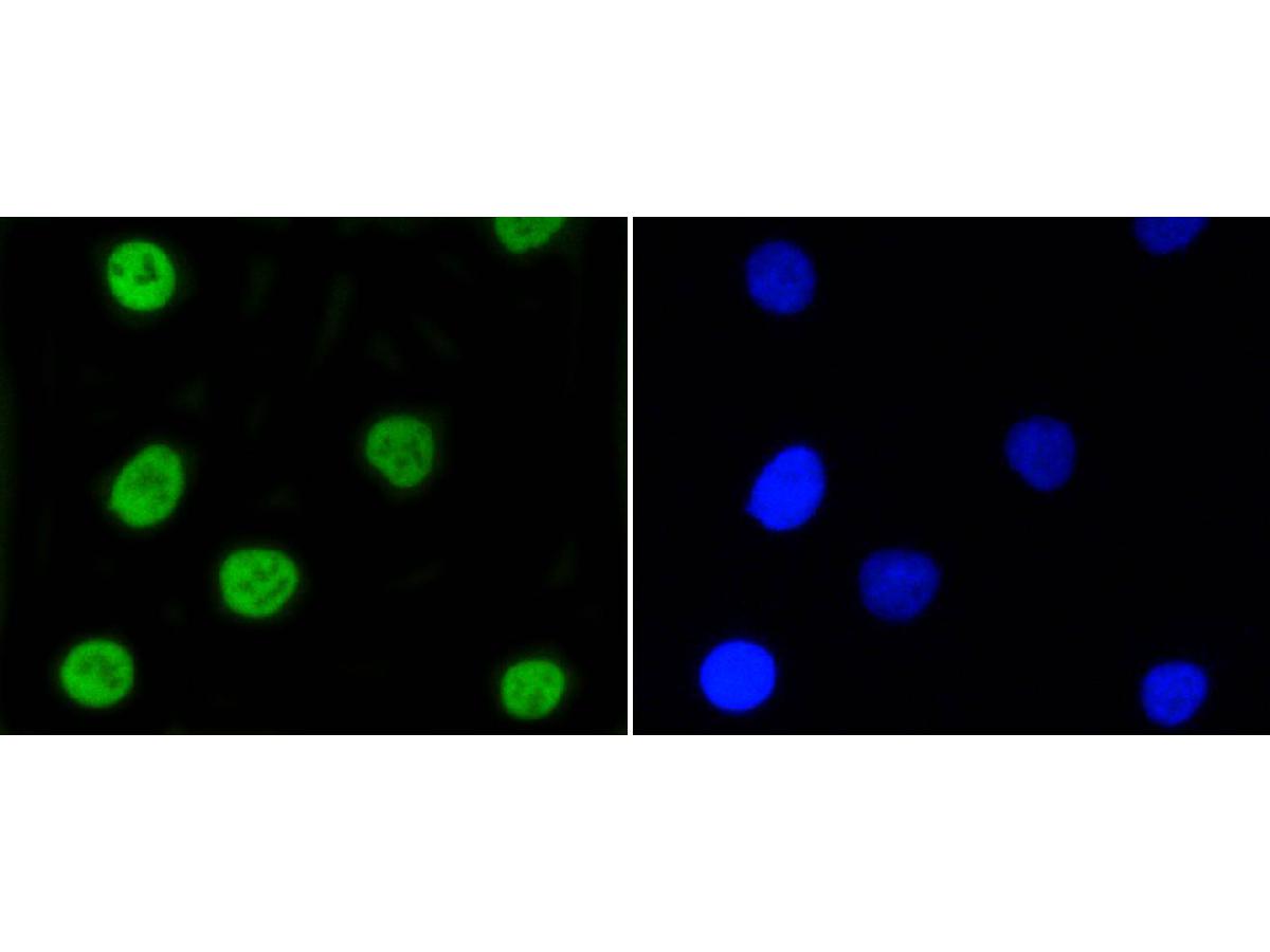 ICC staining of Phospho-Nrf2(S40) in HepG2 cells (green). Formalin fixed cells were permeabilized with 0.1% Triton X-100 in TBS for 10 minutes at room temperature and blocked with 10% negative goat serum for 15 minutes at room temperature. Cells were probed with the primary antibody (ET1608-28, 1/50) for 1 hour at room temperature, washed with PBS. Alexa Fluor®488 conjugate-Goat anti-Rabbit IgG was used as the secondary antibody at 1/1,000 dilution. The nuclear counter stain is DAPI (blue).