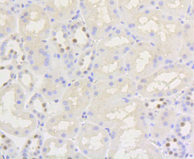 Immunohistochemical analysis of paraffin-embedded human kidney tissue using anti-Phospho-Nrf2(S40) antibody. The section was pre-treated using heat mediated antigen retrieval with Tris-EDTA buffer (pH 9.0) for 20 minutes.The tissues were blocked in 1% BSA for 30 minutes at room temperature, washed with ddH2O and PBS, and then probed with the primary antibody (ET1608-28, 1/50) for 30 minutes at room temperature. The detection was performed using an HRP conjugated compact polymer system. DAB was used as the chromogen. Tissues were counterstained with hematoxylin and mounted with DPX.