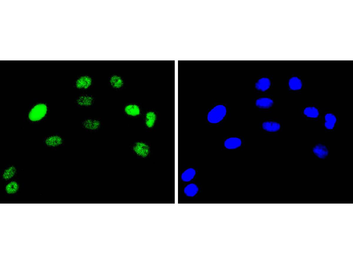 ICC staining of c-Jun in L6 cells (green). Formalin fixed cells were permeabilized with 0.1% Triton X-100 in TBS for 10 minutes at room temperature and blocked with 1% Blocker BSA for 15 minutes at room temperature. Cells were probed with the primary antibody (ET1608-3, 1/50) for 1 hour at room temperature, washed with PBS. Alexa Fluor®488 Goat anti-Rabbit IgG was used as the secondary antibody at 1/1,000 dilution. The nuclear counter stain is DAPI (blue).