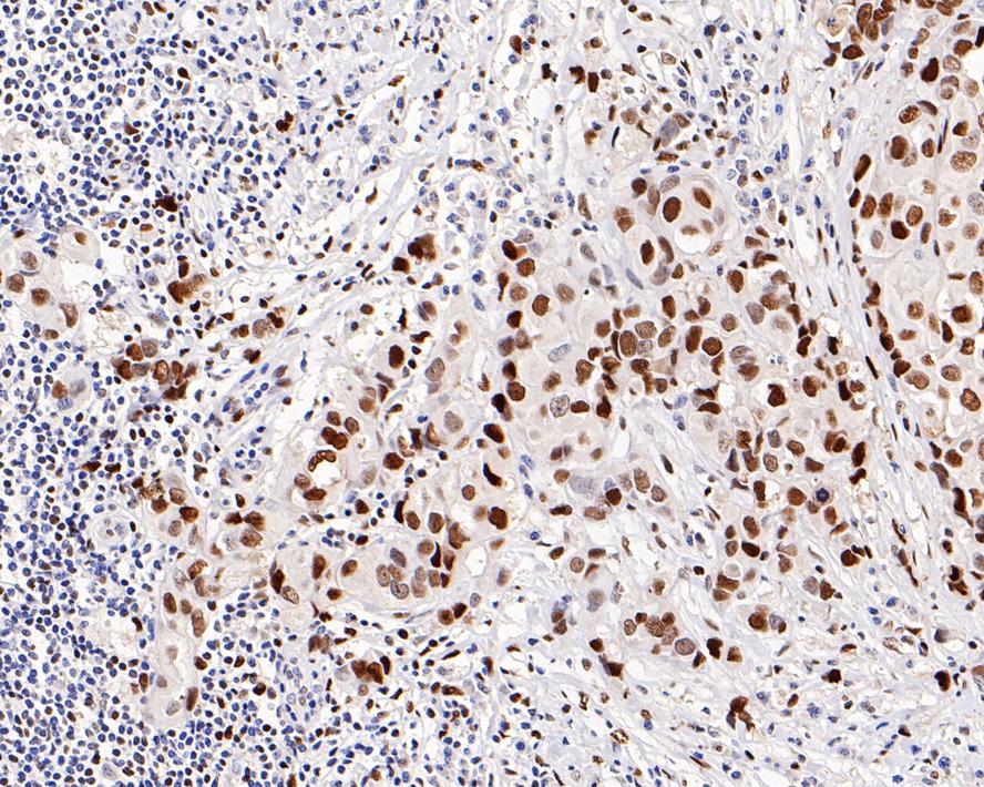 ICC staining of c-Jun in NIH/3T3 cells (green). Formalin fixed cells were permeabilized with 0.1% Triton X-100 in TBS for 10 minutes at room temperature and blocked with 1% Blocker BSA for 15 minutes at room temperature. Cells were probed with the primary antibody (ET1608-3, 1/50) for 1 hour at room temperature, washed with PBS. Alexa Fluor®488 Goat anti-Rabbit IgG was used as the secondary antibody at 1/1,000 dilution. The nuclear counter stain is DAPI (blue).