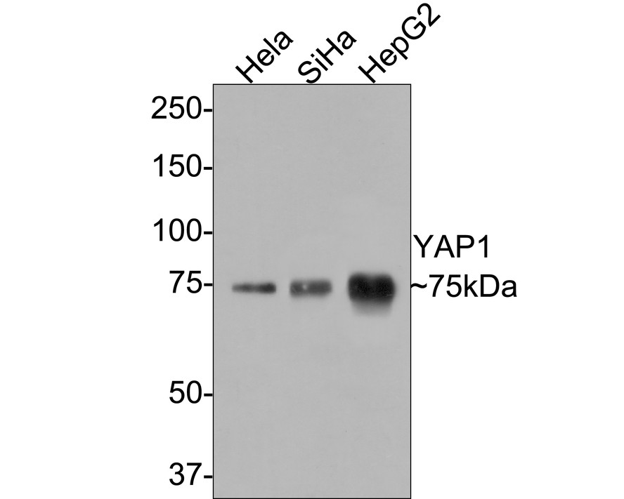 Western blot analysis of YAP1 on different lysates with Rabbit anti-YAP1 antibody (ET1608-30) at 1/500 dilution.<br />
<br />
Lane 1: Hela cell lysate<br />
Lane 2: SiHa cell lysate<br />
Lane 3: HepG2 cell lysate<br />
<br />
Lysates/proteins at 10 µg/Lane.<br />
<br />
Predicted band size: 54 kDa<br />
Observed band size: 75 kDa<br />
<br />
Exposure time: 2 minutes;<br />
<br />
8% SDS-PAGE gel.<br />
<br />
Proteins were transferred to a PVDF membrane and blocked with 5% NFDM/TBST for 1 hour at room temperature. The primary antibody (ET1608-30) at 1/500 dilution was used in 5% NFDM/TBST at room temperature for 2 hours. Goat Anti-Rabbit IgG - HRP Secondary Antibody (HA1001) at 1:300,000 dilution was used for 1 hour at room temperature.