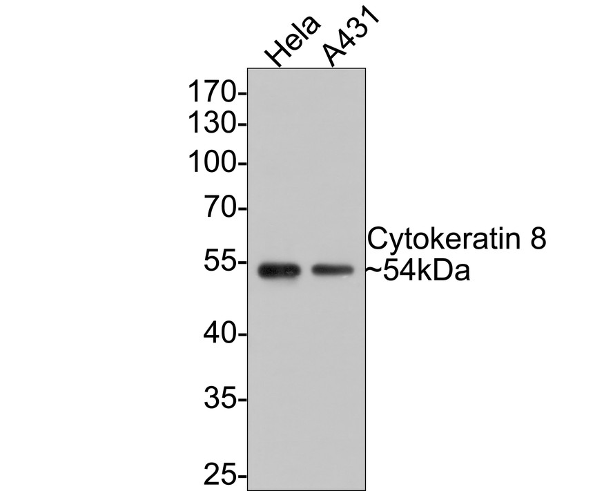 Western blot analysis of Cytokeratin 8 on different lysates with Rabbit anti-Cytokeratin 8 antibody (ET1608-32) at 1/1,000 dilution.<br />
<br />
Lane 1: Hela cell lysate<br />
Lane 2: A431 cell lysate<br />
<br />
Lysates/proteins at 10 µg/Lane.<br />
<br />
Predicted band size: 92 kDa<br />
Observed band size: 92 kDa<br />
<br />
Exposure time: 30 seconds;<br />
<br />
10% SDS-PAGE gel.<br />
<br />
Proteins were transferred to a PVDF membrane and blocked with 5% NFDM/TBST for 1 hour at room temperature. The primary antibody (ET1608-32) at 1/1,000 dilution was used in 5% NFDM/TBST at room temperature for 2 hours. Goat Anti-Rabbit IgG - HRP Secondary Antibody (HA1001) at 1:300,000 dilution was used for 1 hour at room temperature.